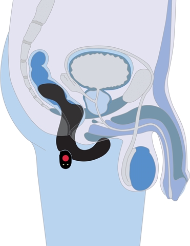 Duke Prostate Stimulator ALT1 view 